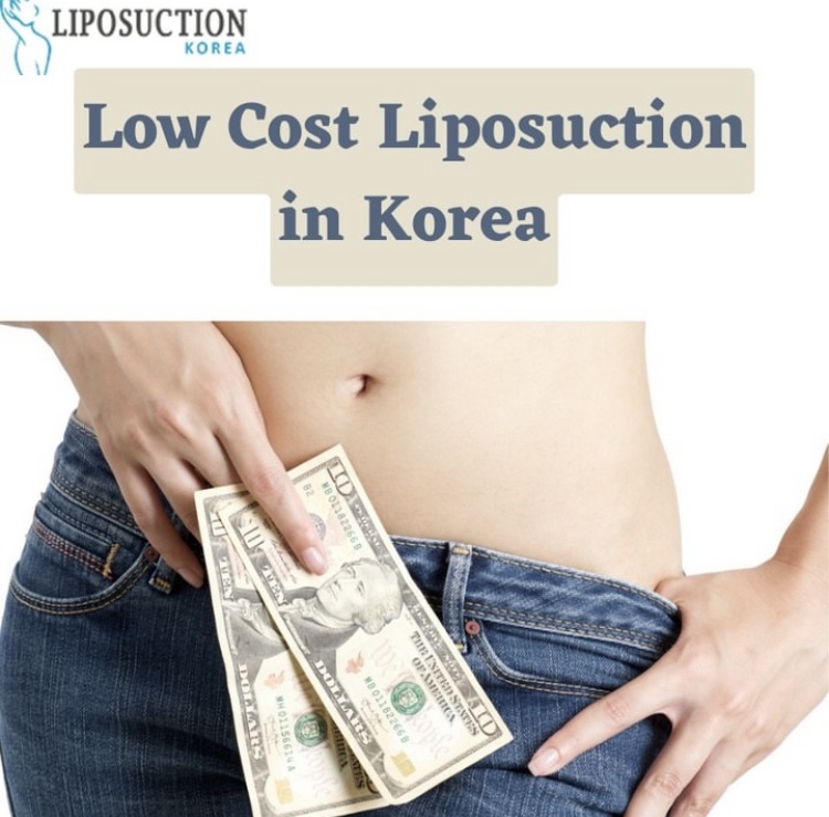 liposuction-cost